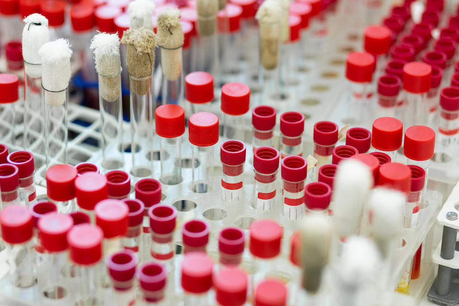 Personalized Medicine Approaches in Drug Development